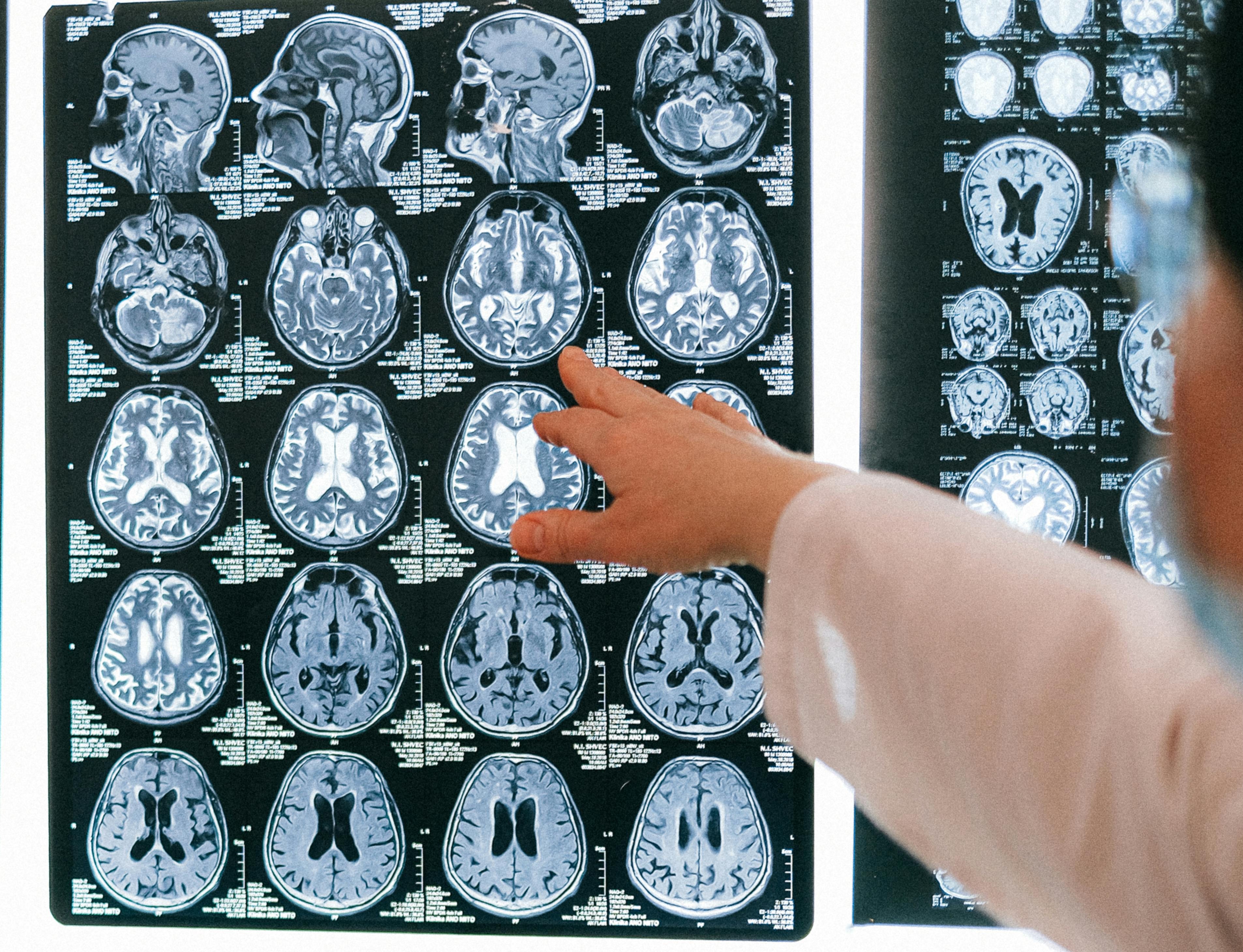 MRI anatomical image